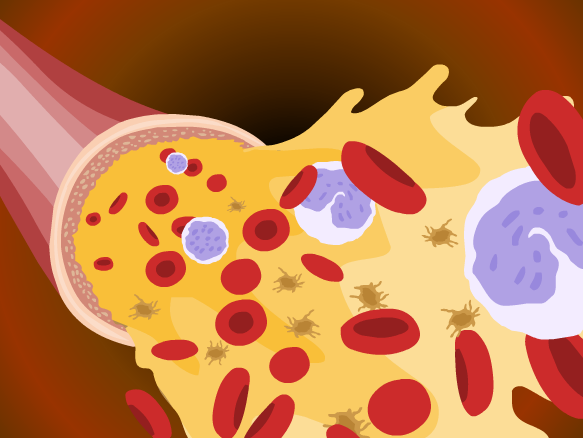 Lymphatic System